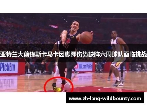 亚特兰大前锋斯卡马卡因脚踝伤势缺阵六周球队面临挑战